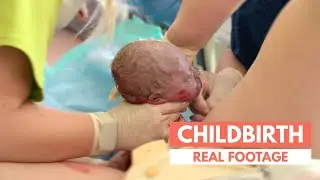 Natural Delivery | Real Footage