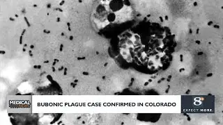 Bubonic plague case confirmed in Colorado