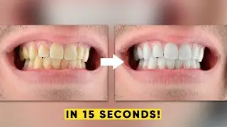 How to Whiten Teeth in Photoshop in 15 seconds! - Whiten Teeth in Photoshop - Photoshop #shorts