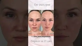 Это УДИВИТЕЛЬНЫЙ РЕЗУЛЬТАТ❗️
