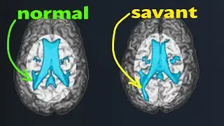 The True Potential of the Human Brain