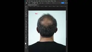 Fix baldness with photoshop 2024 