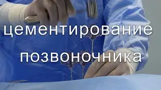 Вертебропластика или цементирование позвоночника