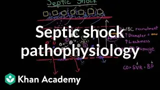 Septic shock - pathophysiology and symptoms | NCLEX-RN | Khan Academy