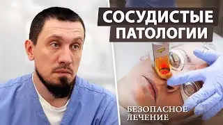 Как мы лечим сосудистую сетку лазером?