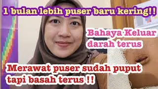 PUSAR BAYI TIDAK KUNJUNG KERING!! BAHAYA PUSAR BAYI BERDARAH TERUS!! CARA MENGATASI PUSAR BAYI BASAH