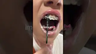 Using A Mascara Brush On Your Braces ISN'T A Crazy Idea! 😅🦷