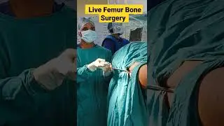 Live Femur Bone Surgery | 