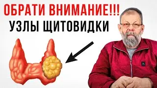 Узелки в щитовидной железе: мифы и реальность. Полное объяснение!