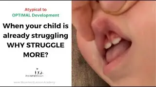 Atypical Development Baby Tongue Tie and Lip Revision and Development