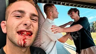 First Day of College *I got Stitches*