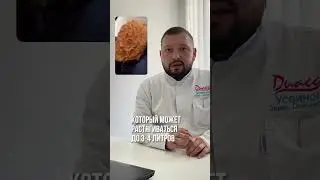 Как выглядит ЖЕЛУДОК изнутри? Блог хирурга о медицине и здоровье! Подписывайся #врач