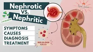 Nephrotic vs. Nephritic syndrome | Symptoms, diagnosis, causes, treatment | Visual explanation