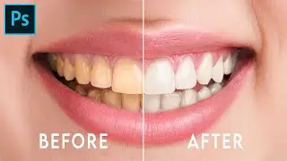 Teeth Whitening in Photoshop - Photoshop tutorial #shorts #photoshop #tutorial #shortvideo