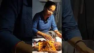 1 दिन का बच्चा, पेशाब रास्ता से गया बहुत Blood. लेकर आया Hospital #pregnancy #infertility #happiness