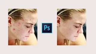 REMOVE BLEMISHES using Photoshop