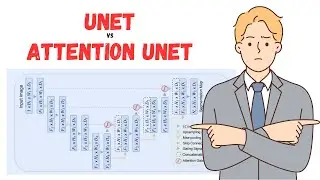 Take Your Tensorflow Skills to New Heights with Attention Unet
