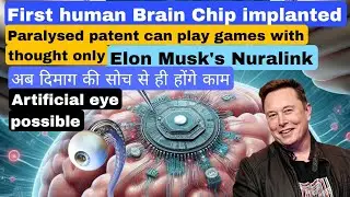 Elon musk Nuralink brain implant successful Paralysed patient plays games by thoughts only latest