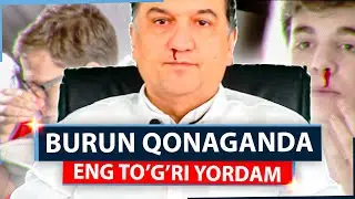 Burun qonashi sabablari (to'g'ri yordam ko'rsatish). Аgаr аri chаqsа