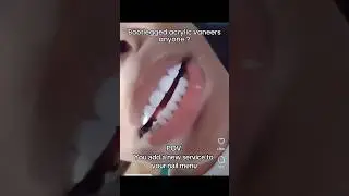 Why You SHOULDN’T Go To A Nail Tech For Veneers! 💅🦷