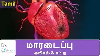 Heart Attack (ACS & MI) | Tamil