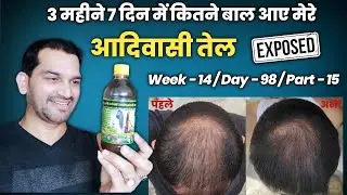 Adivasi Hair oil honest review | Adivasi Neelambari Herbal Hair Oil | Adivasi Hair Oil Review