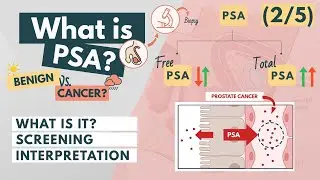 Prostate Specific Antigen (PSA) | Overview for Med Students | Urology