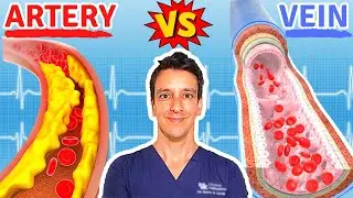 Why do we get plaque in Arteries but not in Veins?!? | The Scientific Explanation