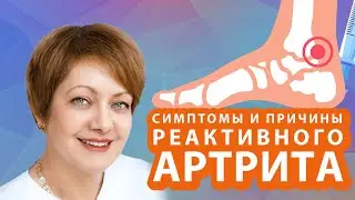 СИМПТОМЫ И ПРИЧИНЫ РЕАКТИВНОГО АРТРИТА // #zdravclinic