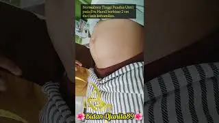Normalnya Tinggi Fundus Uteri pada Ibu Hamil #TFU #Tinggifundusuteri #pregnant #pregnancy #kehamilan