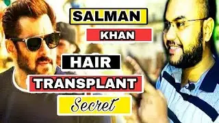 Salman khan hair transplant secret||(PART 1)