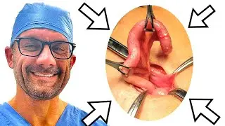 Why do we have an Appendix?