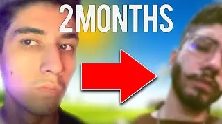 How I got a Beard in 2 Months - Minoxidil Journey