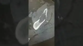 Метастаз саркомы.