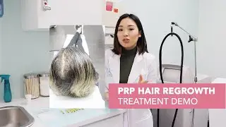 PRP + ACell for Hair Loss for Women with Nurse Angella