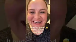 Using Retainer To Close Tooth Gap Before Wedding!?!?! 😅Orthodontist Reacts