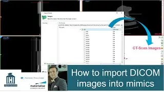 How to import DICOM images into mimics