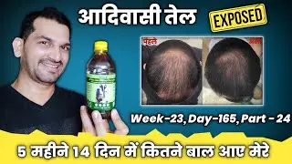 Adivasi Hair oil honest review | Adivasi Neelambari Herbal Hair Oil | Adivasi Hair Oil Review