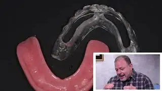 Inside Dentistry Product Talk - Dr. Paul Petrungaro, DDS, MS + LOCATOR F-Tx