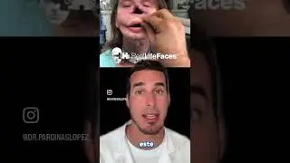 INCREÍBLE prótesis de CARA, NARIZ y LABIOS - Así MEJORARON su VIDA