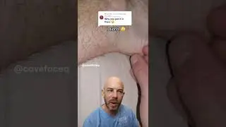 Pulling out a hair splinter lodged in an ankle! #satisfying #dermreacts #doctorreacts #hair