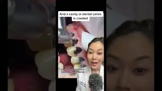 Black cavities on EVERY tooth. 