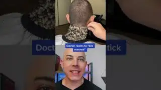 Derm reacts to “tick removal” 
