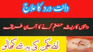 Daant Dard Ka Pakka Ilaj | Danton Ka Resha Khatam Karne Ka Tarika| Treatment Of Dental Pus |دانت درد