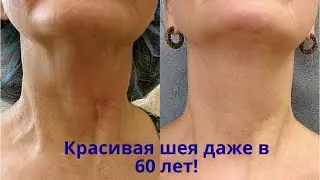 Подтяжка шеи и декольте! Красивая кожа даже в 60 лет! Недорогие аптечные средства вместо косметики!