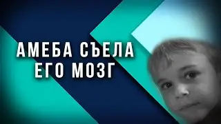 АМЁБА СЪЕЛА МОЗГ СЕМИЛЕТНЕГО МАЛЬЧИКА: Реальная История 