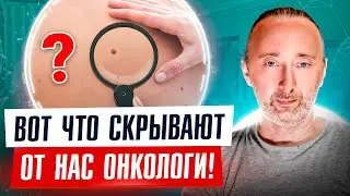 7 причин МЕЛАНОМЫ! Особый осмотр, защита и лечение от РАКА кожи! ЭТО скрывают от нас онкологи!