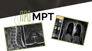 Про МРТ