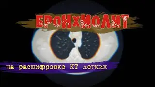 Локальный ПНЕВМОФИБРОЗ и БРОНХИОЛИТ у взрослых на РАСШИФРОВКЕ КТ легких (второе мнение)