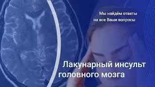 Лакунарный инфаркт головного мозга